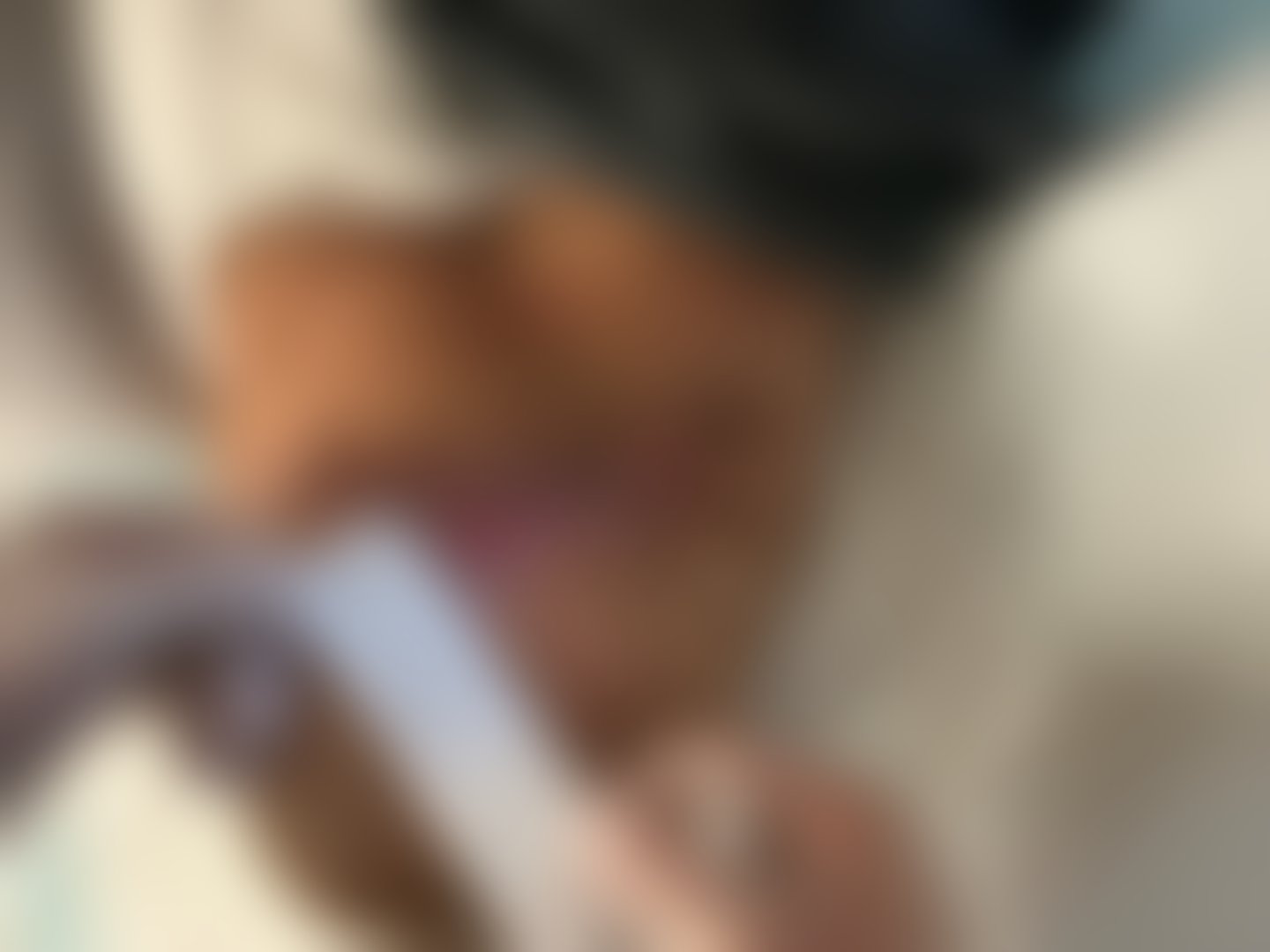 Privacy-blurred clinical image — BEFORE