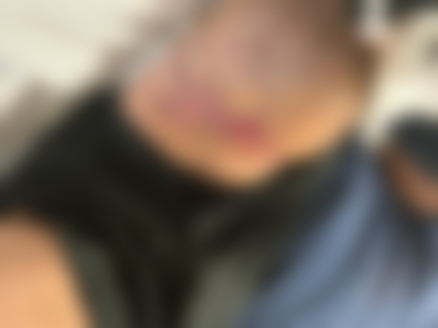 Privacy-blurred clinical image — FOLLOW-UP